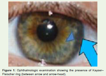Wilson s Disease A Brief Review With Neuroimaging Features