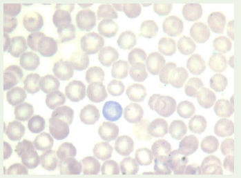 JAP-2330-2178-05-0039-fig1